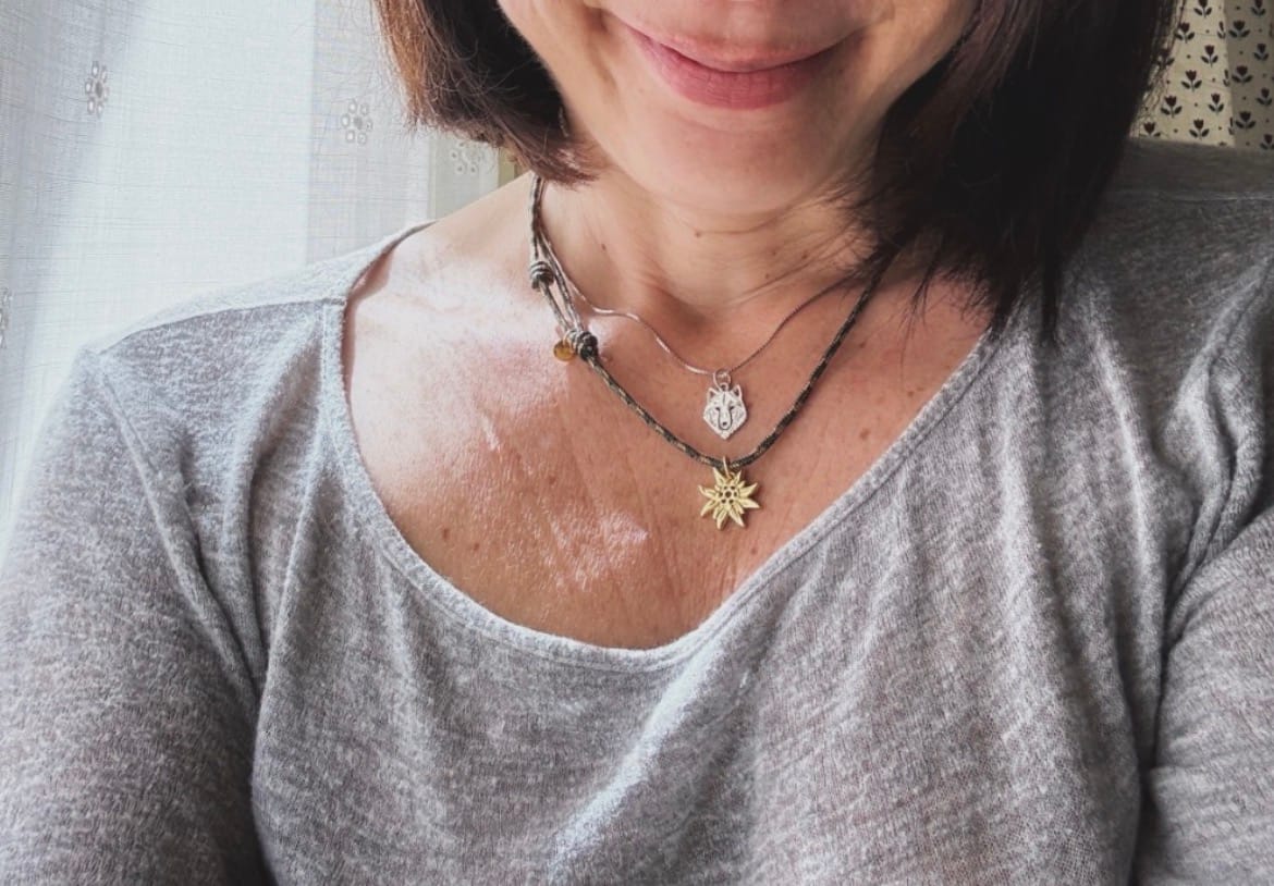 Customer photo review of Collana Stella Alpina di luce – charm argento 925 placato oro