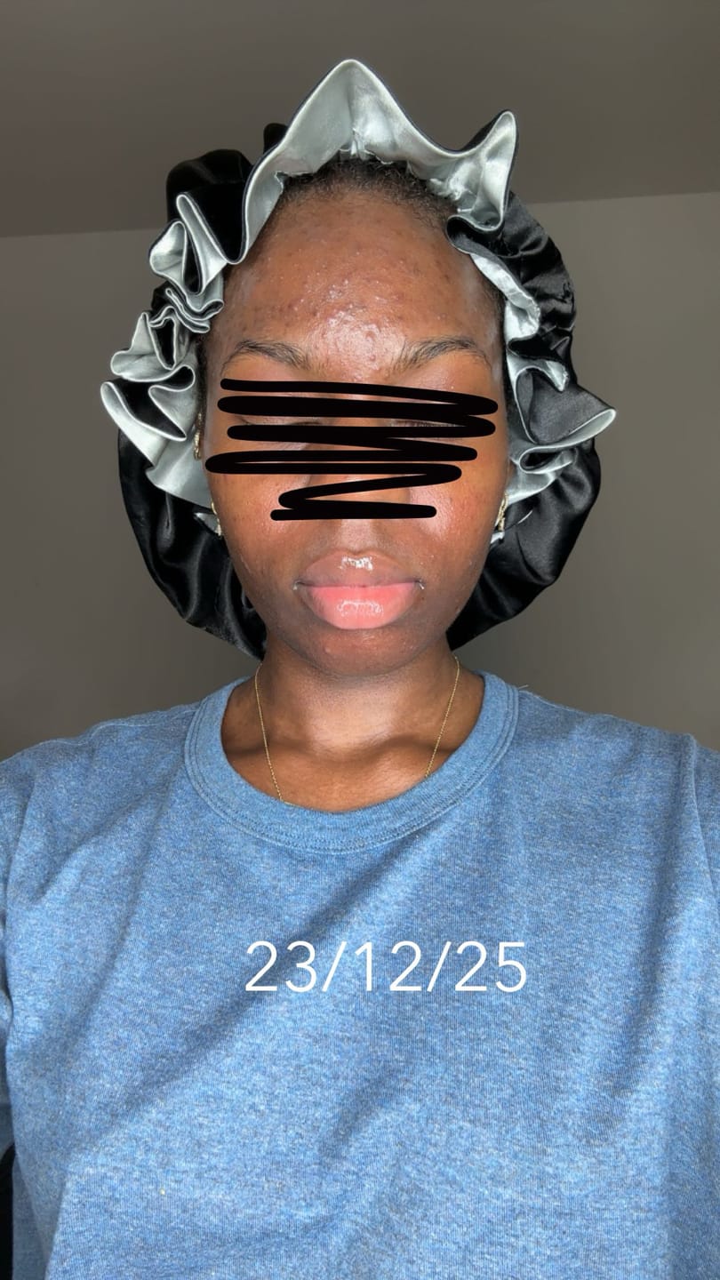 Customer photo review of Savon visage biscuit