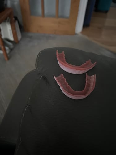 Customer photo review of 🦷  Fit Full Functional DenturesMake you more confident-Made in the USA & FDA-Certified