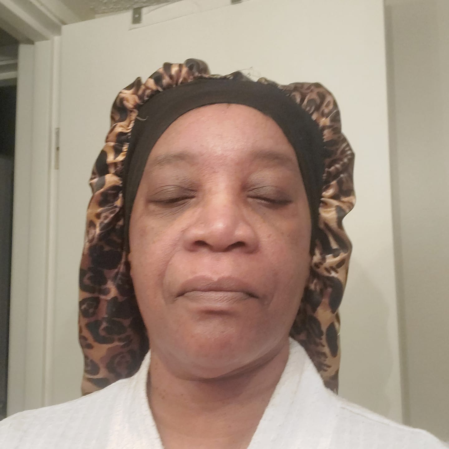 Customer photo review of Turmeric Brightening Soap (with Vitamin C, Alpha Arbutin, Oat)