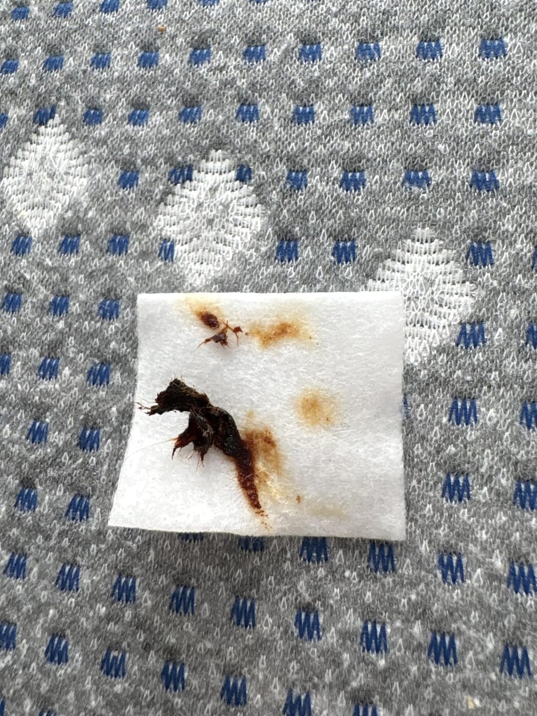 Customer photo review of Earclean - Doktor Onaylı 1080P Kulak Temizlik Kamerası