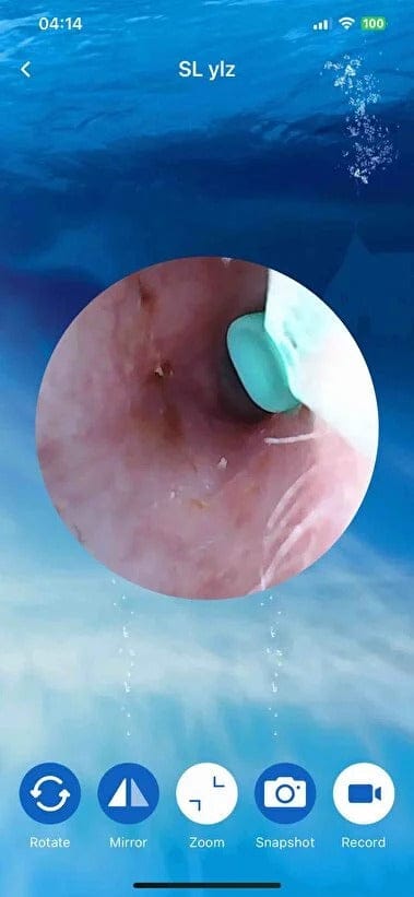 Customer photo review of Earclean - Doktor Onaylı 1080P Kulak Temizlik Kamerası