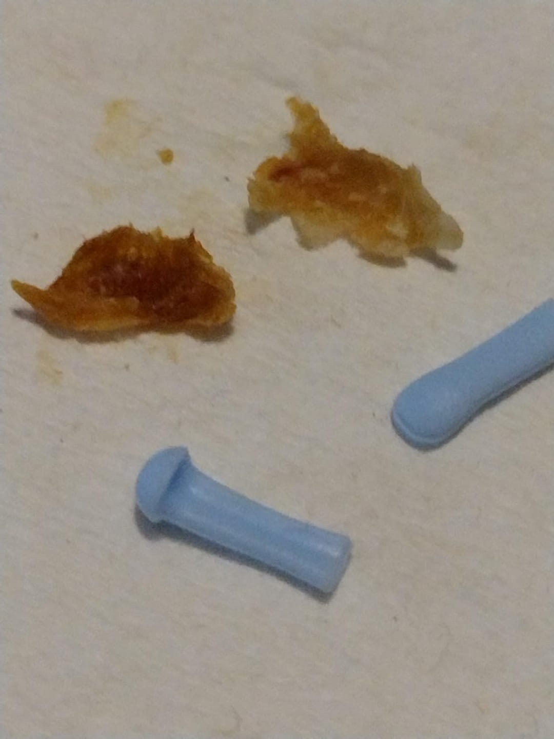 Customer photo review of Earclean - Doktor Onaylı 1080P Kulak Temizlik Kamerası