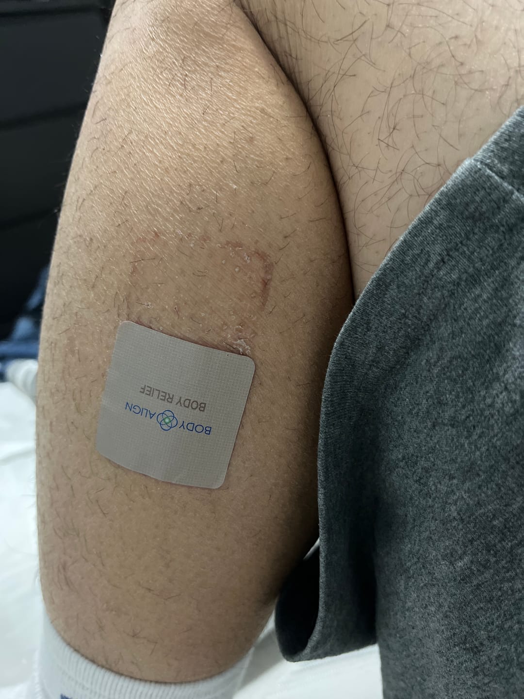 Customer photo review of Body Relief Patch