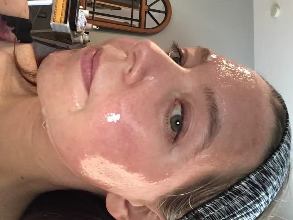 Customer photo review of Linea Collagene Elixèa