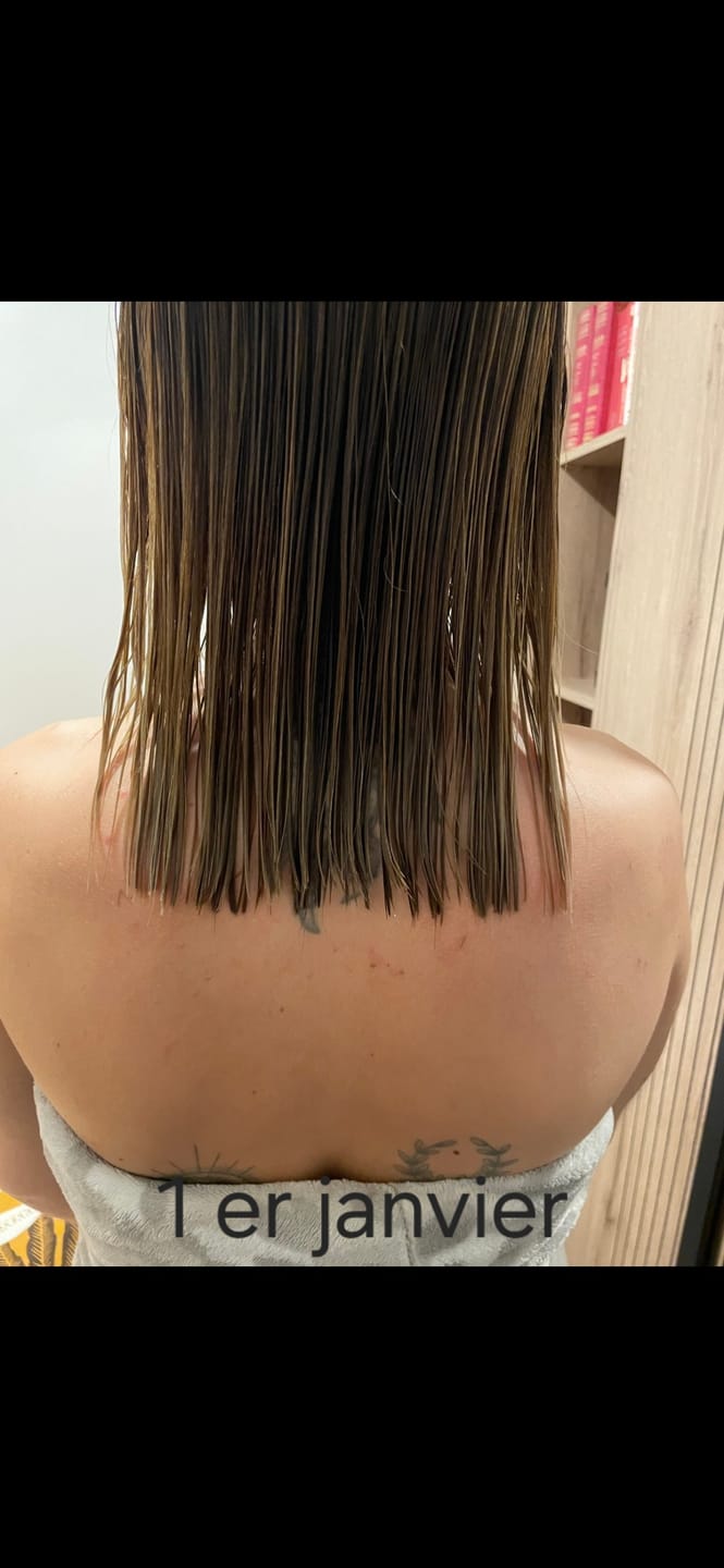 Customer photo review of Duo cheveux - Anti-Chute & Pousse rapide