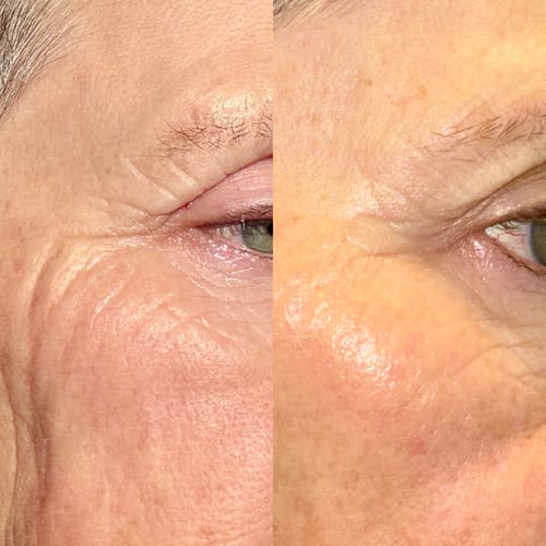 Close-up before-and-after view of a reviewer's eye area, showing smoother skin after using Deep Collagen Cream.