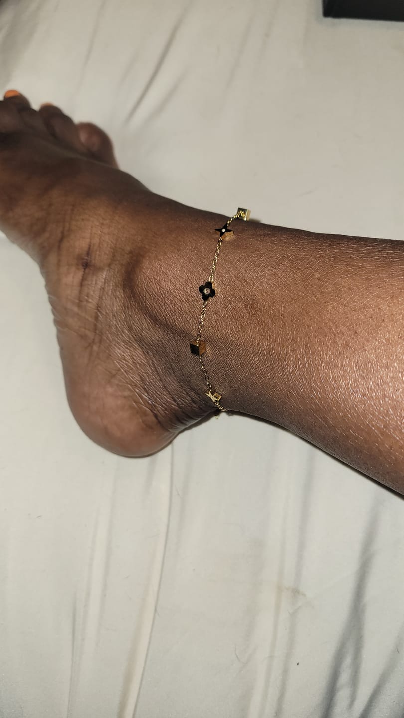 Customer photo review of Charlie Gold Anklet
