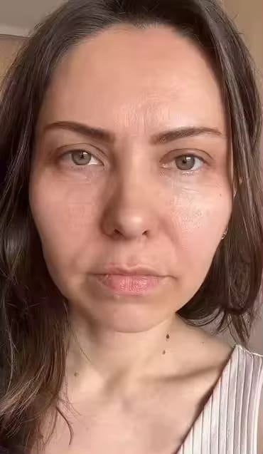 Customer photo review of Linea Collagene Elixèa