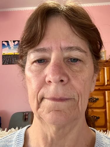 Close-up of a reviewer's face before using The Micro Infusion System.