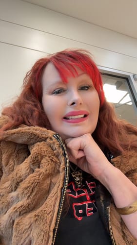Customer photo review of Imako® Cosmetic Teeth Kit