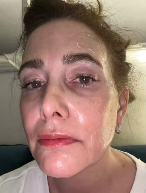 Customer photo review of Linea Collagene Elixèa
