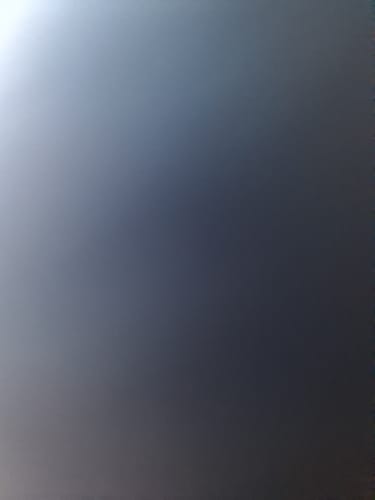 Customer photo review of 🦷  Fit Full Functional DenturesMake you more confident-Made in the USA & FDA-Certified