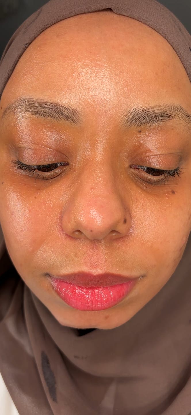 Customer photo review of Eyelash Serum
