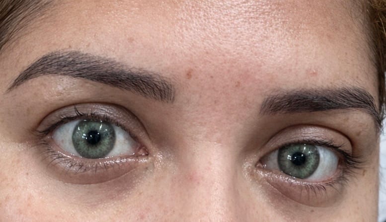 Customer photo review of Cherry OCEAN Blue Prescription Colored Contact Lenses