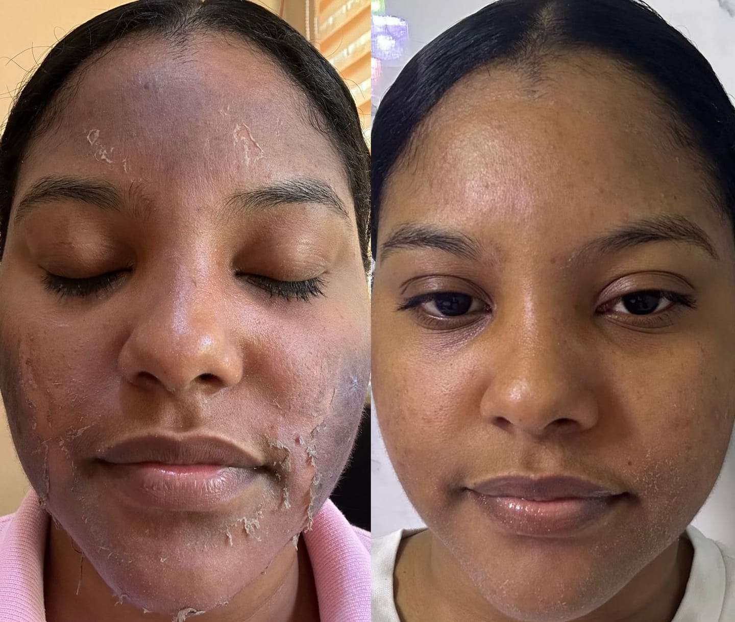 Customer photo review of Zena 100% Organic Algae Peel