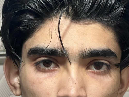 Close-up of a customer's face showing smooth, hydrated skin after using Essense Hydrating Lotion.