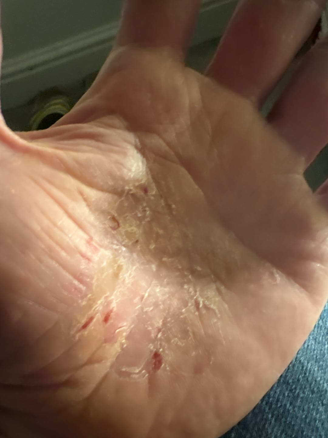 Customer photo review of Bioskin Duo Pack
