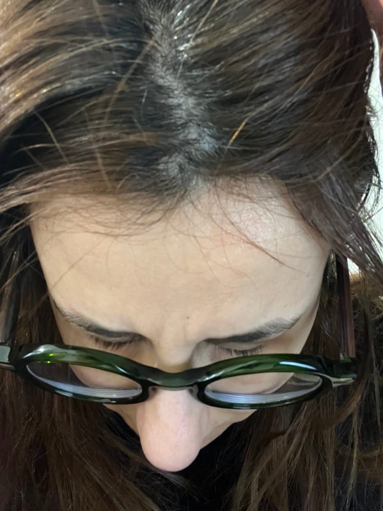 Customer photo review of Sérum de croissance pour cheveux (3 mois)