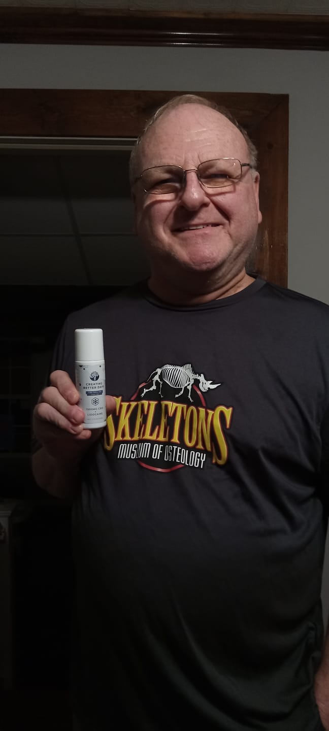 Customer photo review of Menthol CBD Roll On with Lidocaine 1500MG
