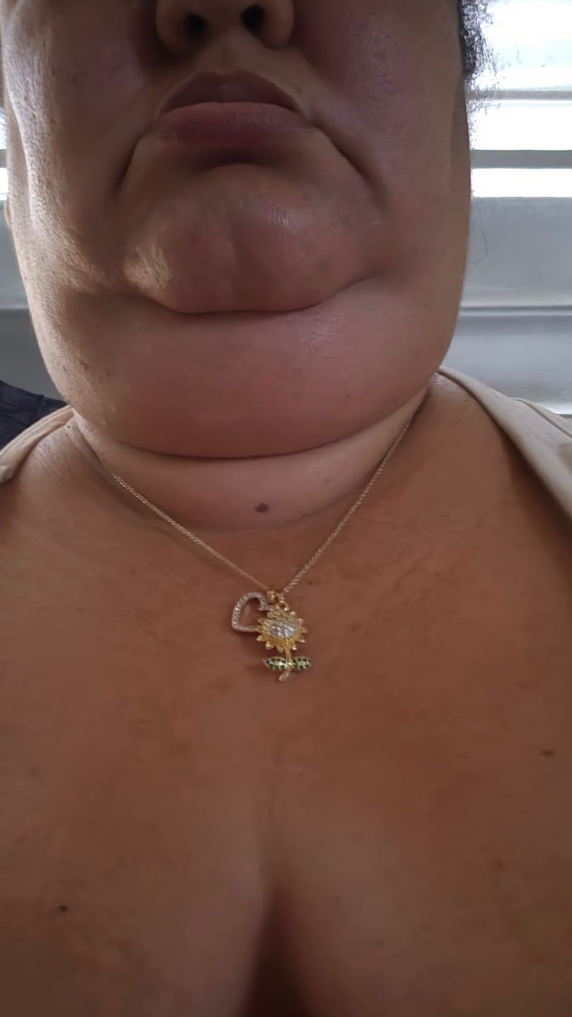 Customer photo review of Girasol