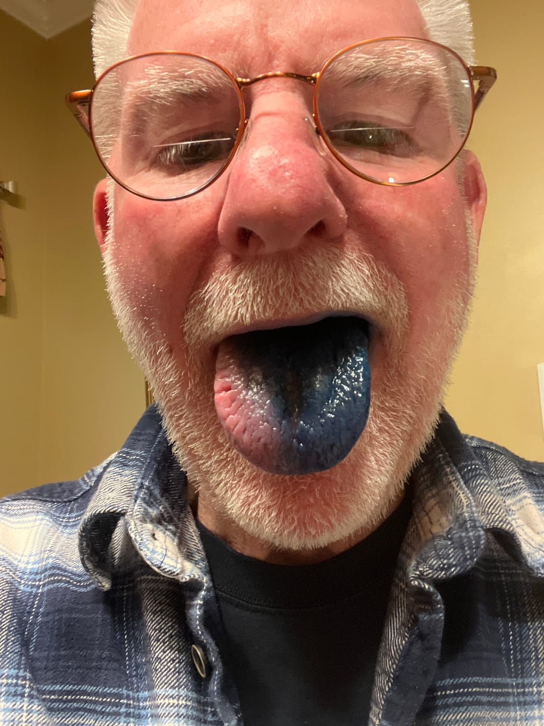 Customer photo review of Damn Good™ Methylene Blue Tincture - 50mL (30 Servings)