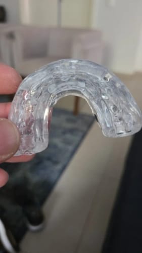 Customer photo review of MOUTHPIECE™ Snore Solution Expert