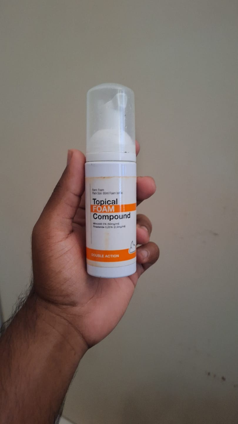 Customer photo review of Minoxidil+DHT Blocker FOAM, MEN ONLY 3x60ml Pack
