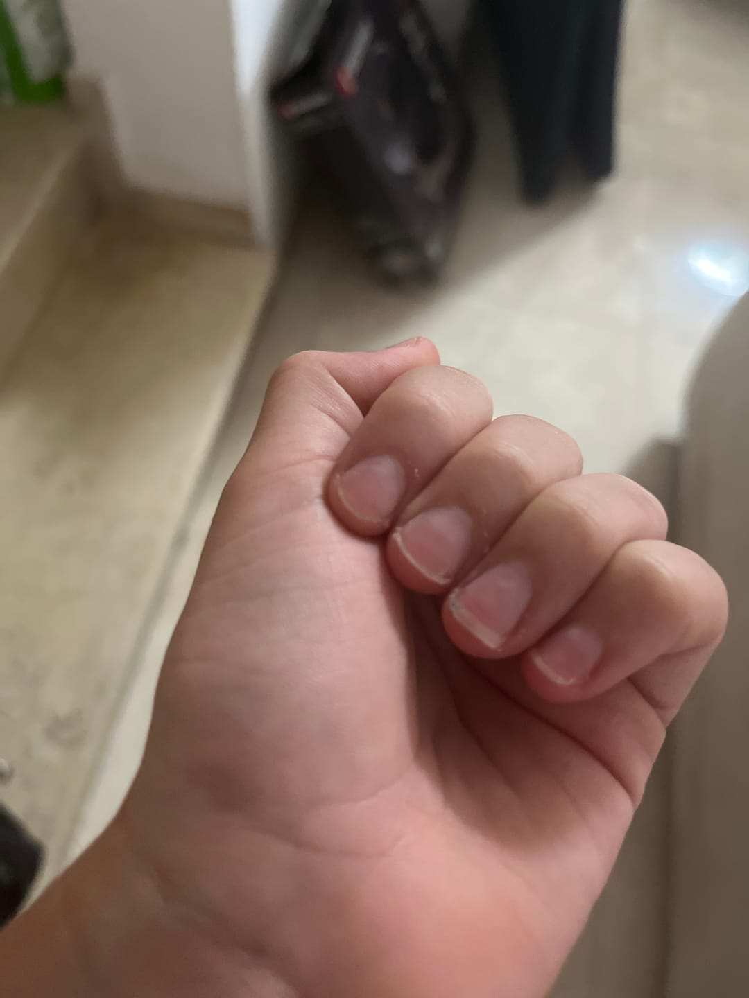 Customer photo review of עט השמן של NOVELA לשיקום הציפורן והעור