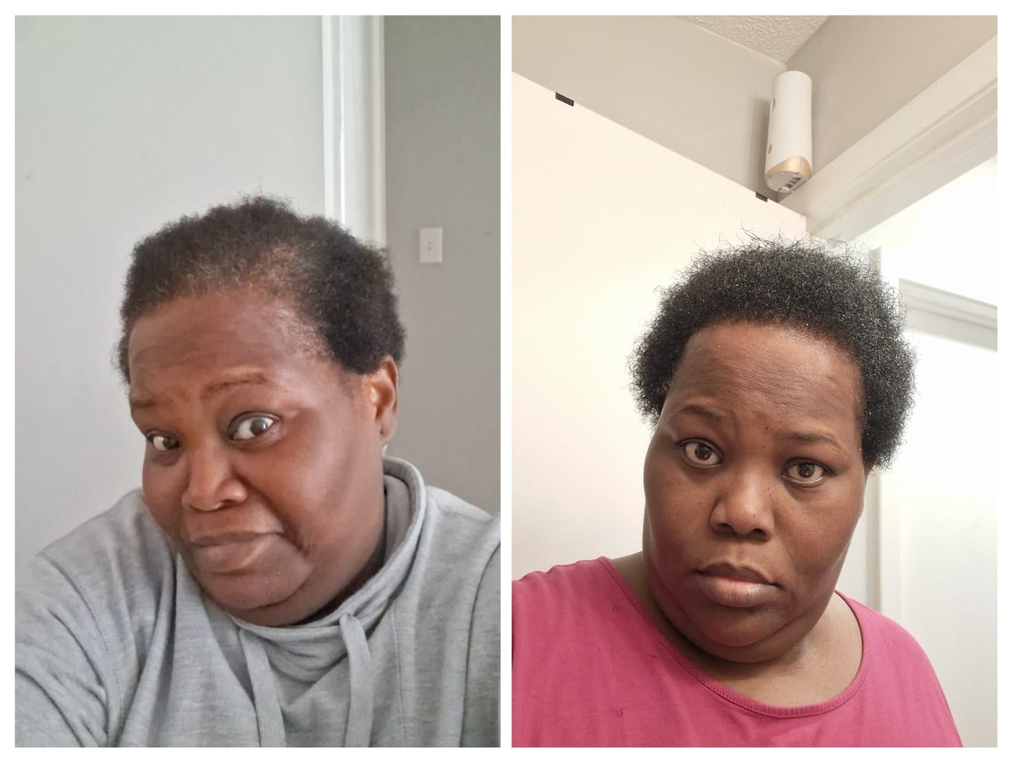 Customer photo review of Gro & Glow Liquid Vitamins - 2 Month Supply!