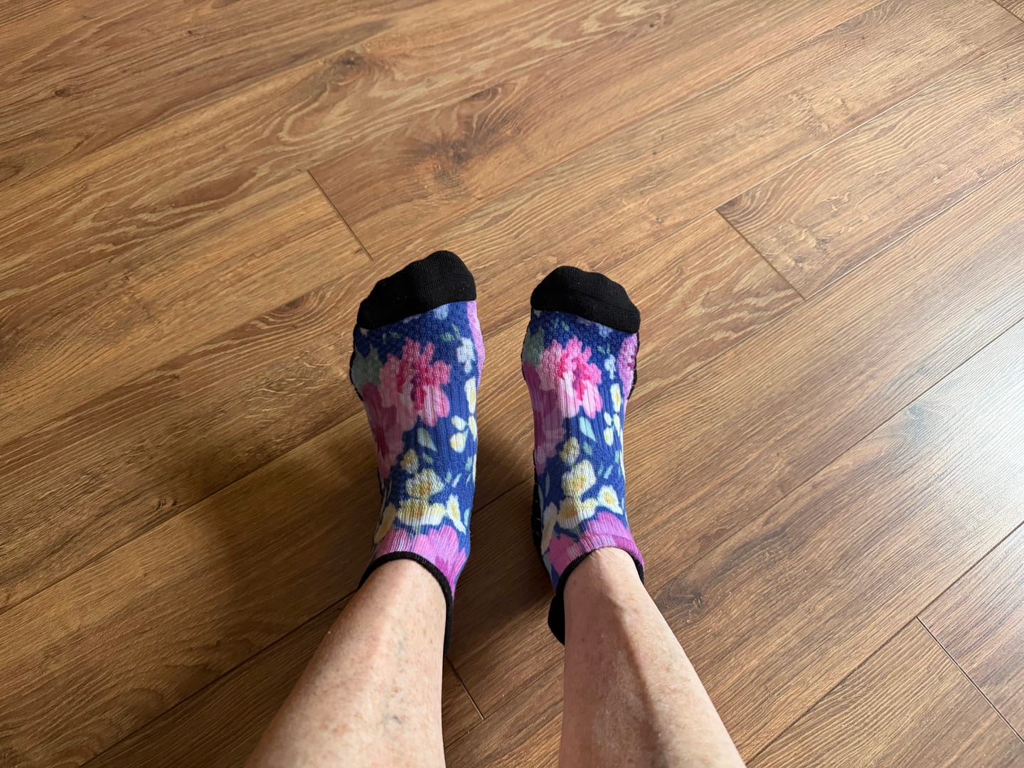 Customer photo review of Blooming Brights Ankle Compression Socks 5-Pack Bundle