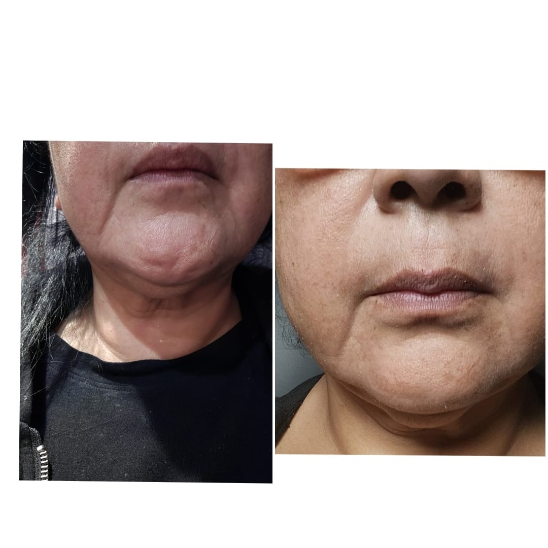 Customer photo review of INIA Microcurrent Conductive Gel