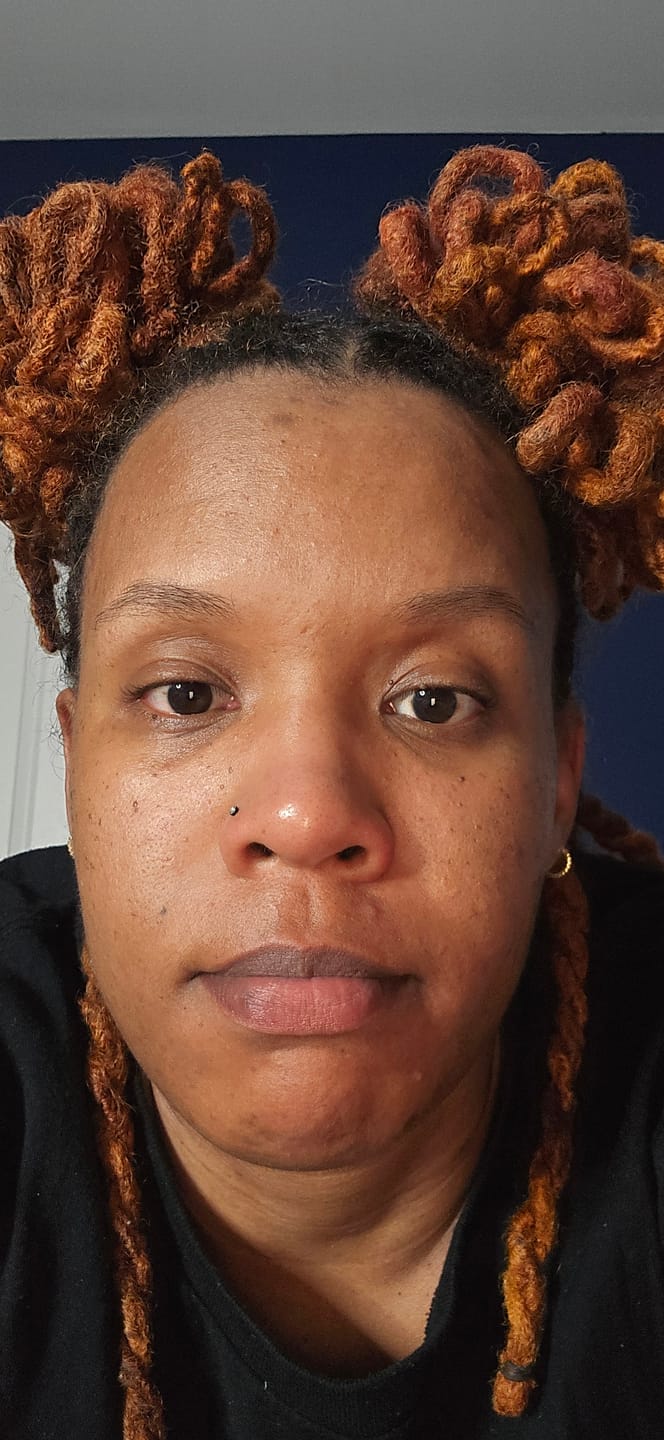 Customer photo review of Turmeric Brightening Soap (with Vitamin C, Alpha Arbutin, Oat)