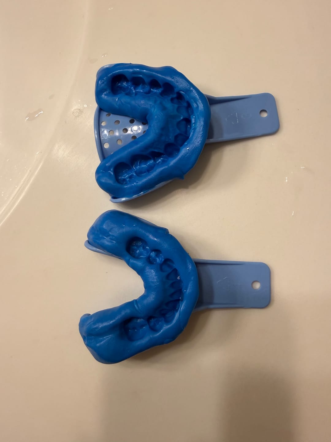 Customer photo review of Clear Custom Night Guard