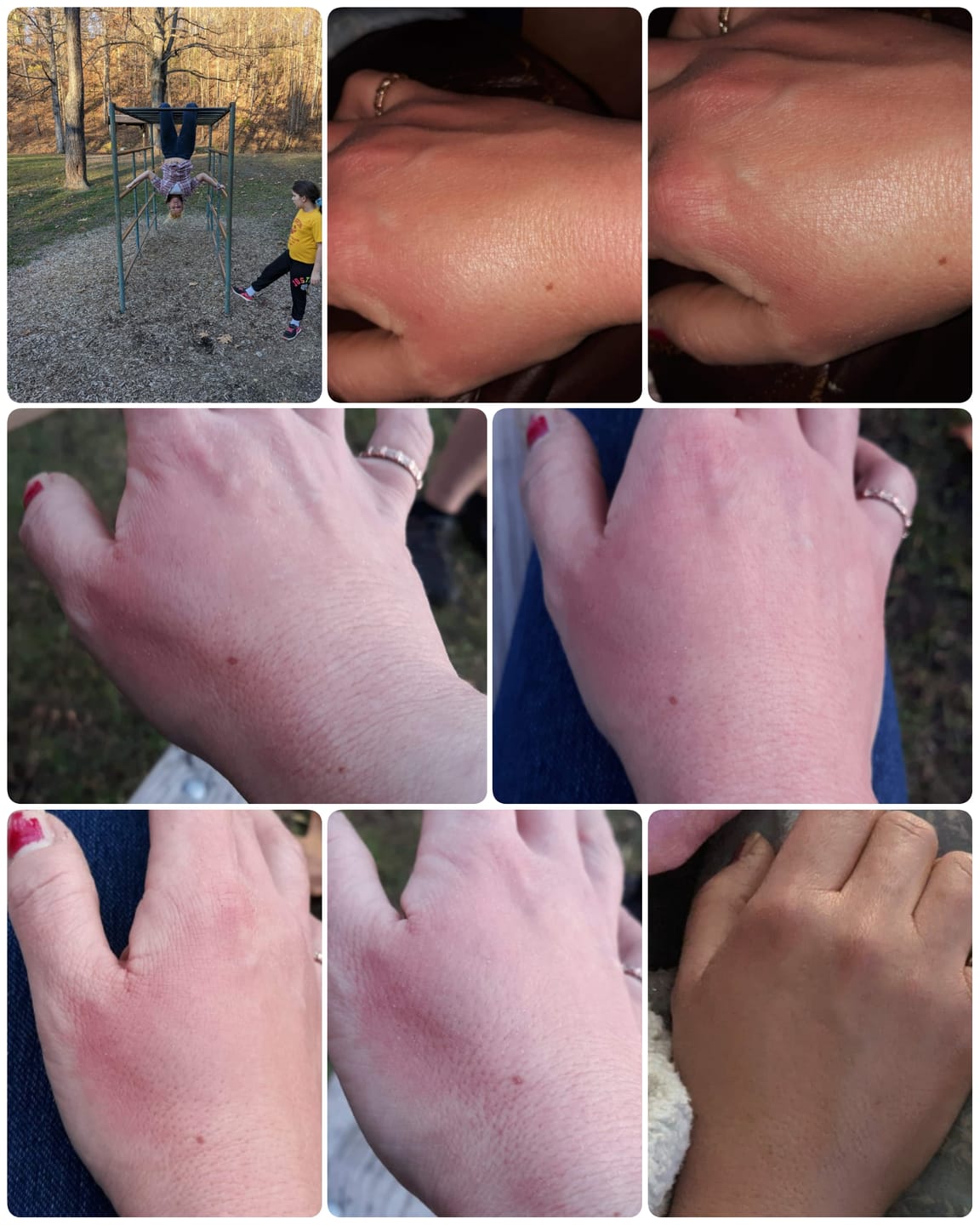 Customer photo review of Qi Coil™ Mini System - Mobile Rife & PEMF Therapy