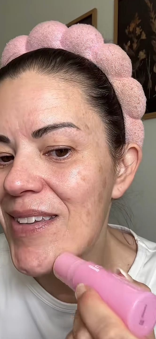 Customer photo review of PDRN Piel más firme y con menos lineas visible en 14 días — sin agujas