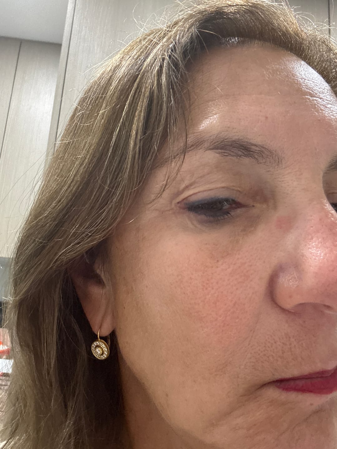 Customer photo review of Deep Collagen Cream