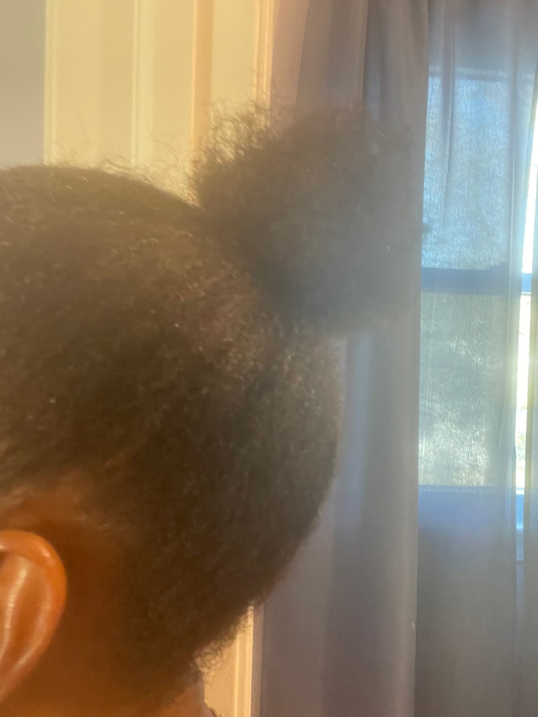 Allyson K. Hairfinity Scalp Elixir customer photo