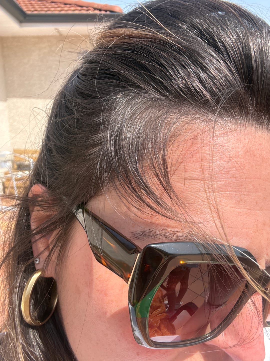 Customer photo review of Pack Cheveux Pousse et Anti-chute