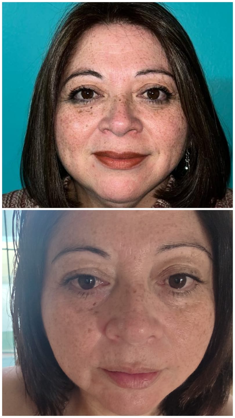 Customer photo review of Crema facial fluida hidratante Amplen Ácido Hialurónico 130ml