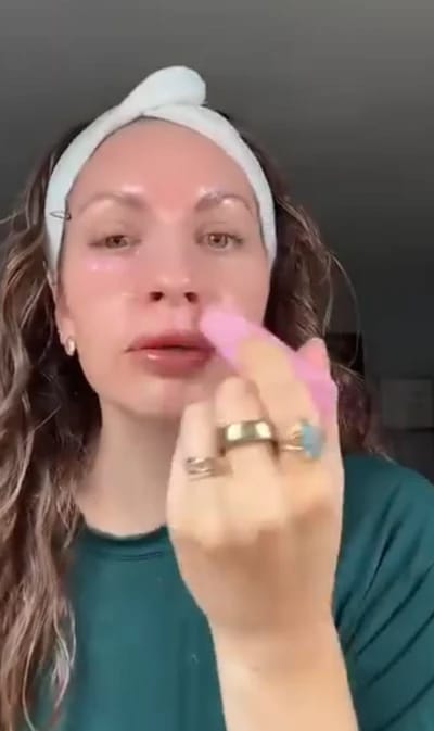 Customer photo review of PDRN Piel más firme y con menos lineas visible en 14 días — sin agujas