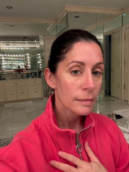 Customer photo review of PDRN Piel más firme y con menos lineas visible en 14 días — sin agujas