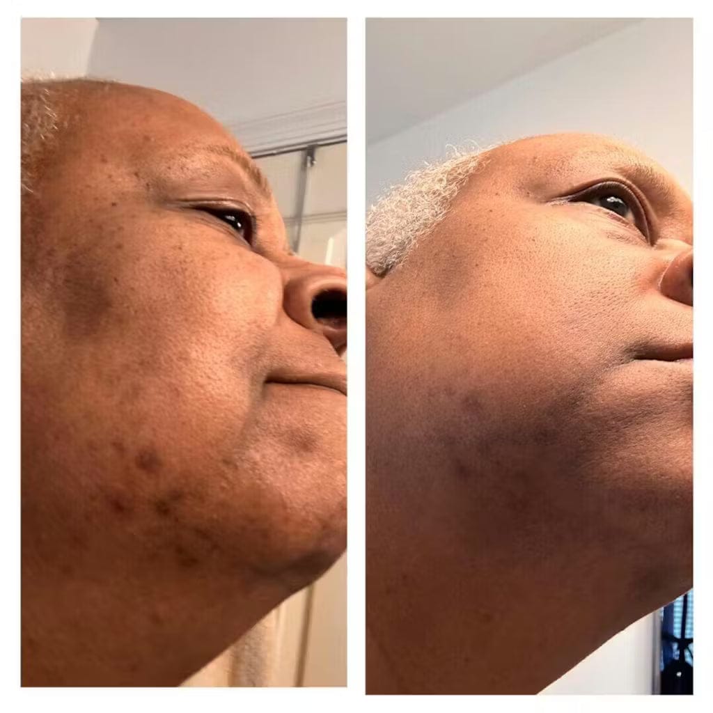 Customer photo review of Elevair Honey Glow Bar