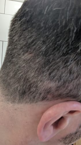 Customer photo review of Seb Natural Calming Serum