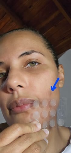 Customer photo review of Parches para Espinillas, uso de día - Nipskin®
