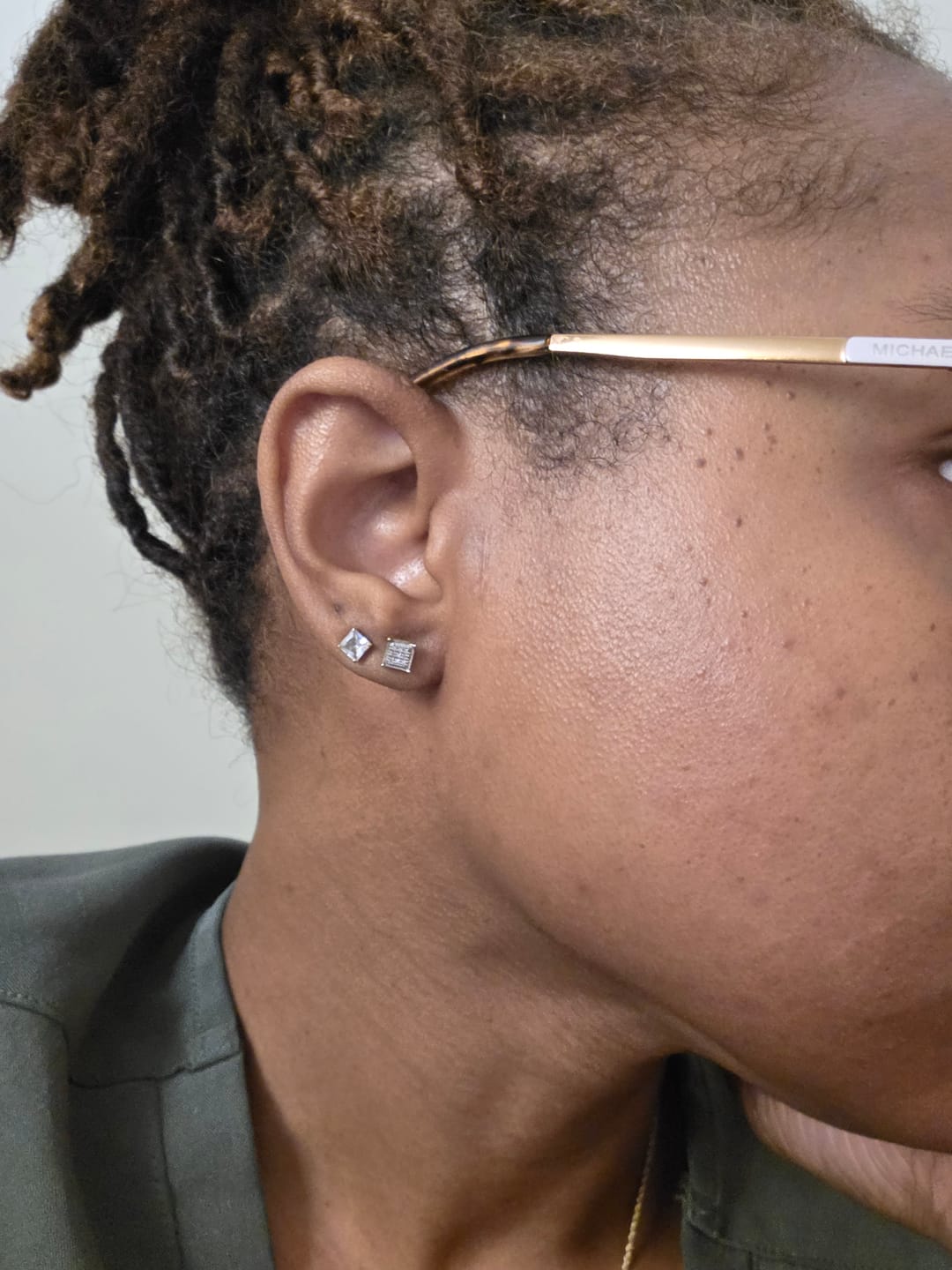 Customer photo review of Turmeric Fade & Glow Bar.