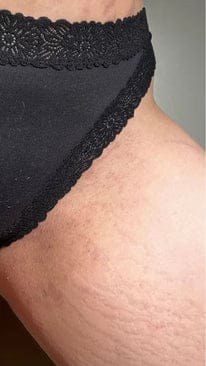 Customer photo review of Elevair Honey Glow Bar