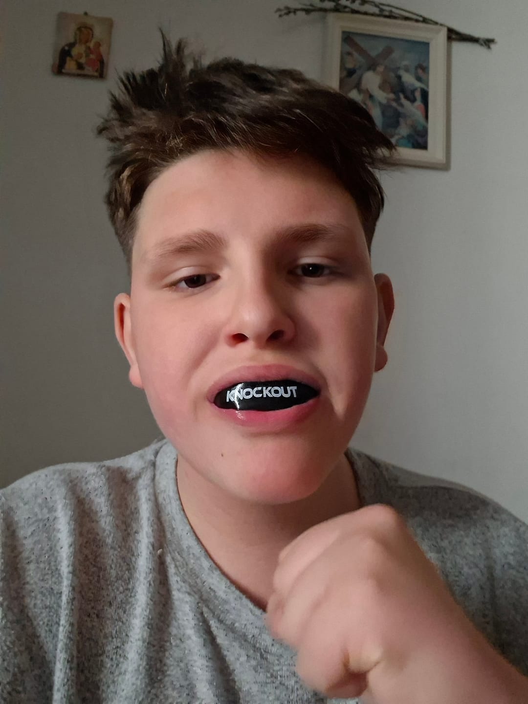 Customer photo review of Proteza Dentara  Knockout GEL