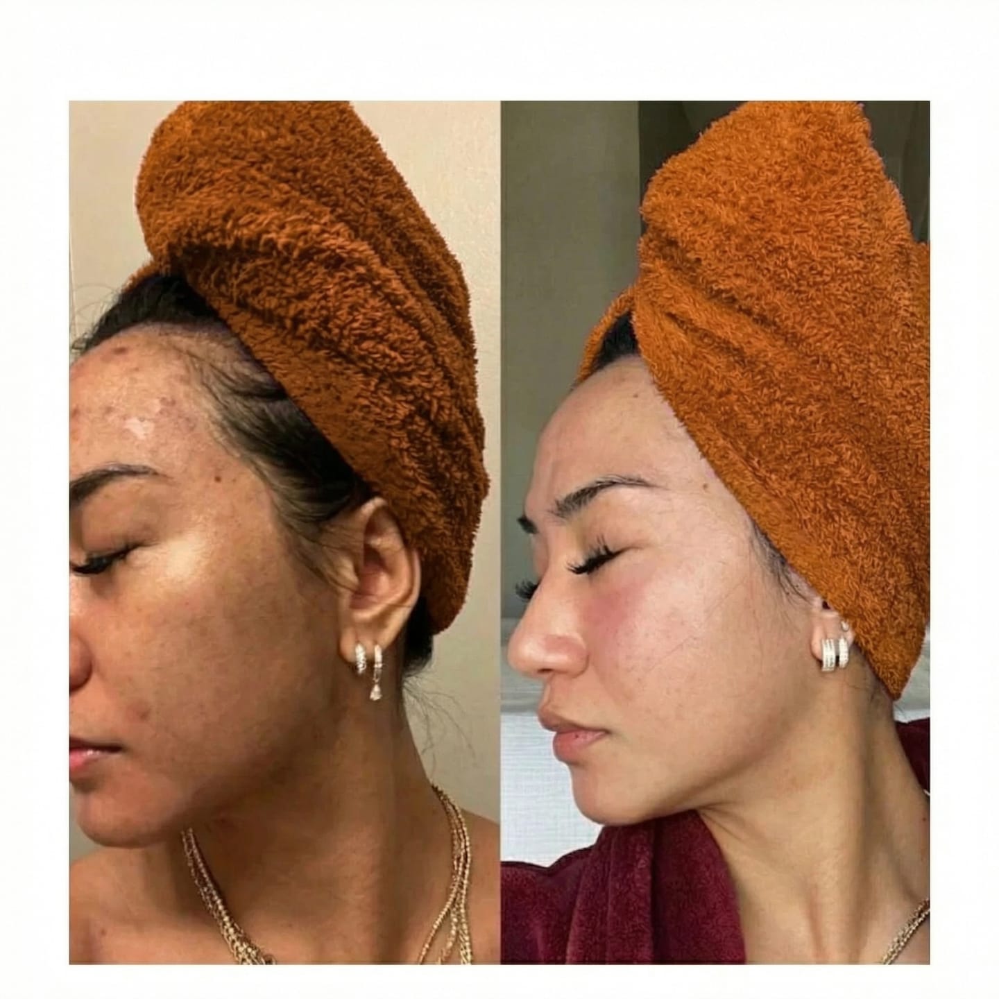 Customer photo review of Elevair Honey Glow Bar