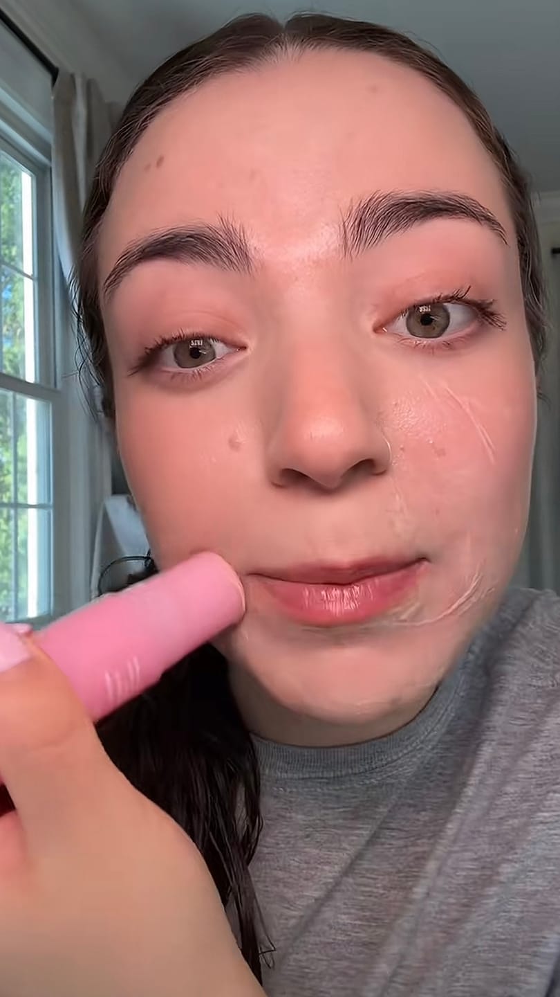 Customer photo review of PDRN Piel más firme y con menos lineas visible en 14 días — sin agujas